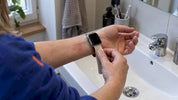 Das Apple Watch Armband führt zu Rötungen am Handgelenk